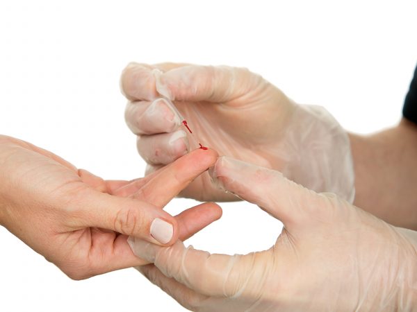 Blodprov coronavirus Mobila Doktorn